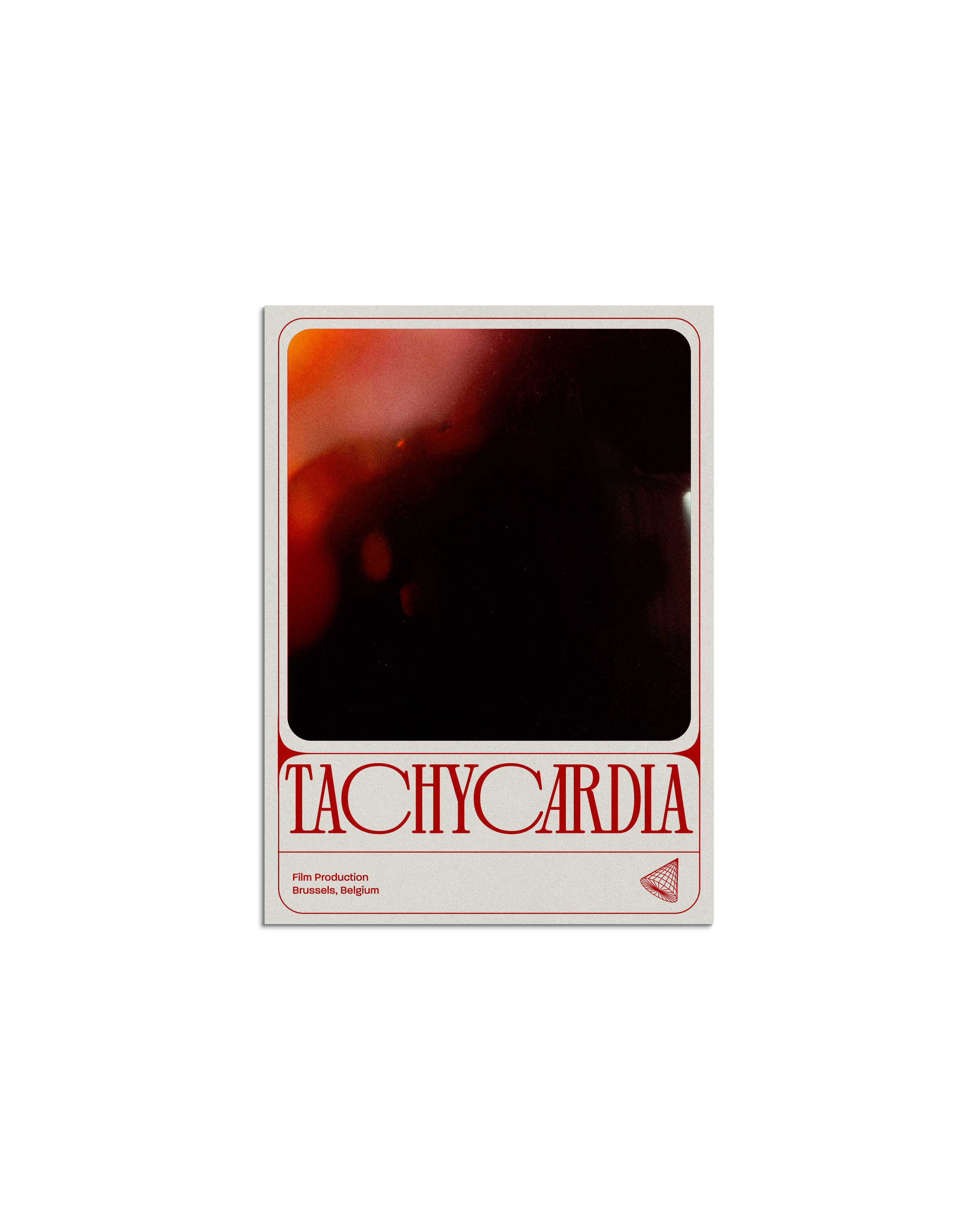 Tachycardia